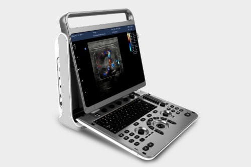 Chison EBit 30