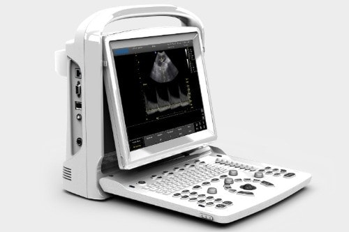 Chison ECO 3 Expert