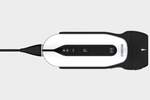 Chison SonoEye P2