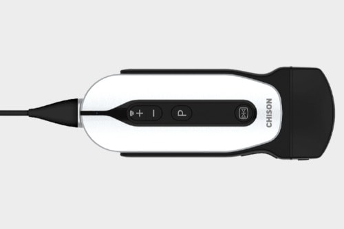 Chison SonoEye P5